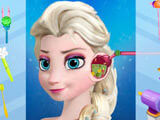Elsa Ear Treatment